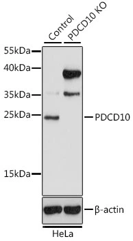 WB analysis of normal (control) and knockout (KO) HeLa cell lysate using GTX35229 PDCD10 antibody. Dilution : 1:1000 Loading : 25microg per lane WB analysis of normal (control) and knockout (KO) HeLa cell lysate using GTX35229 PDCD10 antibody. Dilution : 1:1000 Loading : 25microg per lane