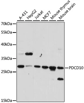 WB analysis of various sample lysates using GTX35229 PDCD10 antibody. Dilution : 1:1000 Loading : 25microg per lane