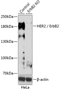 WB analysis of normal (control) and knockout (KO) HeLa cell lysate using GTX35231 Her2 / ErbB2 antibody. Dilution : 1:500 Loading : 25microg per lane WB analysis of normal (control) and knockout (KO) HeLa cell lysate using GTX35231 Her2 / ErbB2 antibody. Dilution : 1:500 Loading : 25microg per lane
