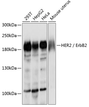 WB analysis of various sample lysates using GTX35231 Her2 / ErbB2 antibody. Dilution : 1:500 Loading : 25microg per lane