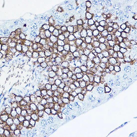 IHC-P analysis of rat testis tissue using GTX35231 Her2 / ErbB2 antibody. Dilution : 1:100