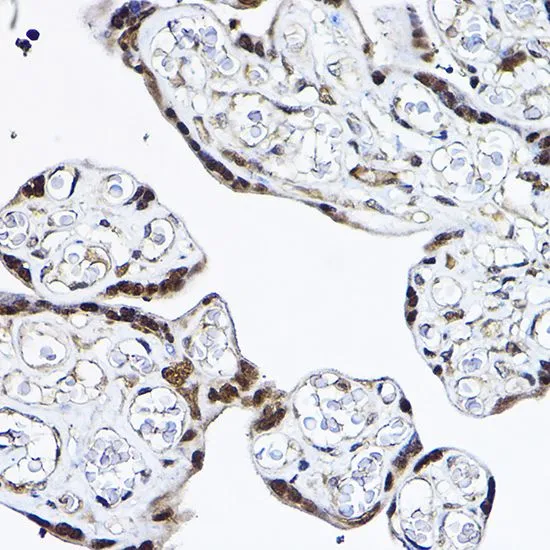 IHC-P analysis of human placenta tissue using GTX35232 PDCD4 antibody. Dilution : 1:25