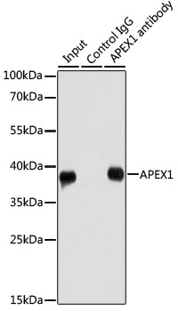 WB analysis of various samples using GTX35233 APE1 antibody. Loading : 25ug per lane Dilution : 1:1000