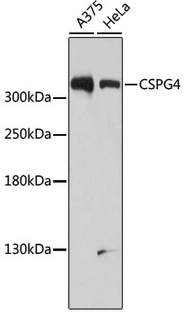 WB analysis of various sample lysates using GTX35234 NG2 antibody. Dilution : 1:1000 Loading : 25microg per lane
