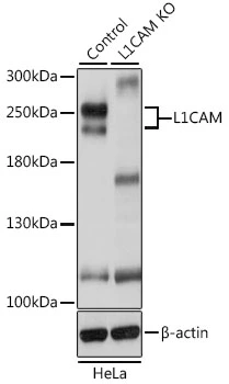 WB analysis of normal (control) and knockout (KO) HeLa cell lysate using GTX35239 L1CAM antibody. Dilution : 1:1000 Loading : 25microg per lane WB analysis of normal (control) and knockout (KO) HeLa cell lysate using GTX35239 L1CAM antibody. Dilution : 1:1000 Loading : 25microg per lane