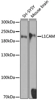 WB analysis of various sample lysates using GTX35239 L1CAM antibody. Dilution : 1:1000 Loading : 25microg per lane