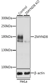 WB analysis of normal (control) and knockout (KO) HeLa cell lysate using GTX35242 PRKCBP1 antibody. Dilution : 1:3000 Loading : 25microg per lane WB analysis of normal (control) and knockout (KO) HeLa cell lysate using GTX35242 PRKCBP1 antibody. Dilution : 1:3000 Loading : 25microg per lane