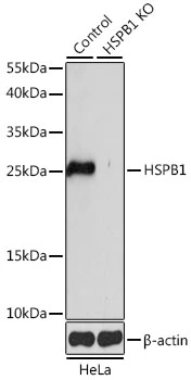 WB analysis of normal (control) and knockout (KO) HeLa cell lysate using GTX35243 HSP27 antibody. Dilution : 1:1000 Loading : 25microg per lane