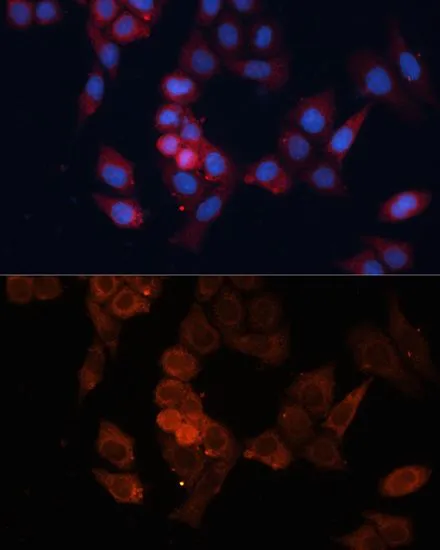 ICC/IF analysis of HeLa cells using GTX35243 HSP27 antibody. Blue : DAPI Dilution : 1:100
