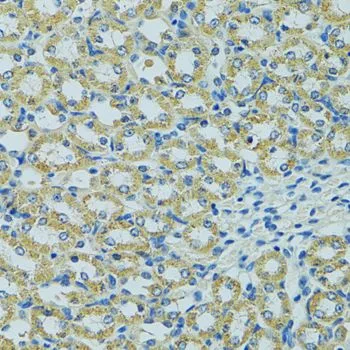 IHC-P analysis of mouse kidney tissue using GTX35243 HSP27 antibody. Dilution : 1:100