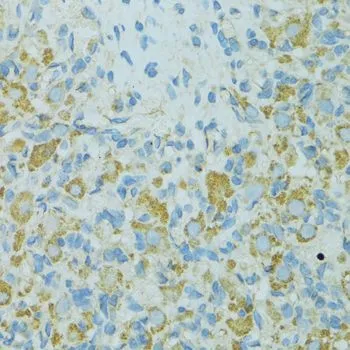 IHC-P analysis of rat ovary tissue using GTX35243 HSP27 antibody. Dilution : 1:100