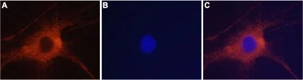 ICC/IF analysis of PFA-fixed rat DRG cells using GTX35259 GluR6 antibody. Panel A : Primary antibody Panel B : DNA dye Hoechst 33342 Panel C : Merged images of panels A and B Dilution : 1:400 ICC/IF analysis of PFA-fixed rat DRG cells using GTX35259 GluR6 antibody. Panel A : Primary antibody Panel B : DNA dye Hoechst 33342 Panel C : Merged images of panels A and B Dilution : 1:400