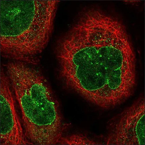ICC/IF analysis of A431 cells using GTX36294 CDC14B antibody.It shows positivity in nuclear membrane. ICC/IF analysis of A431 cells using GTX36294 CDC14B antibody.It shows positivity in nuclear membrane.