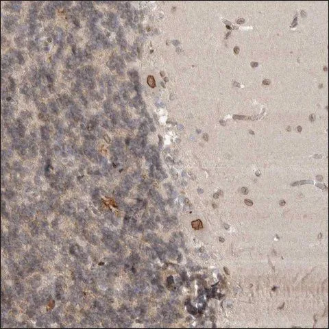 IHC-P analysis of human cerebellum tissue using GTX36294 CDC14B antibody. It shows strong nuclear membranous positivity in Purkinje cells.