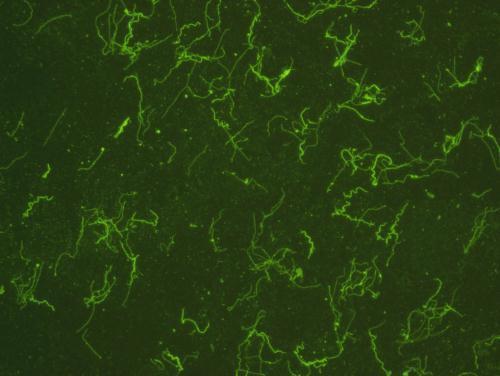 Immunofluorescent staining with GTX36583_Borrelia-burgdorferi_2.jpg.