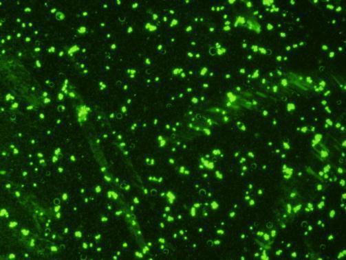 Immunofluorescent staining with GTX36920_E-coli-O157_1061.jpg.