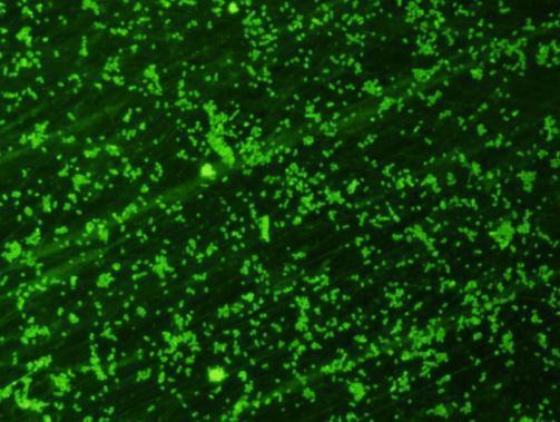 Immunofluorescent staining with GTX36923_E-coli-O157_1026.jpg.