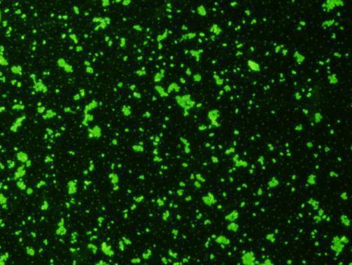 Immunofluorescent staining with GTX36924_E-coli-O157_1025.jpg.