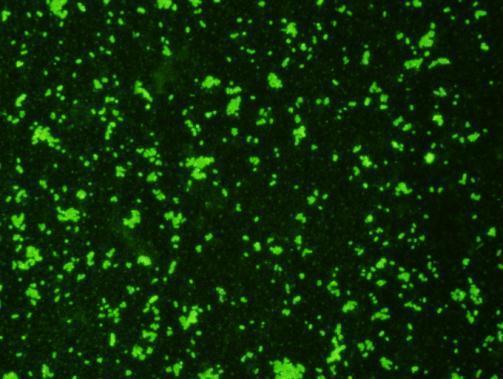 Immunofluorescent staining with GTX36925_E-coli-O157_1024.jpg.