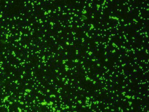 Immunofluorescent staining with GTX36926_E-coli-O157_1023.jpg.