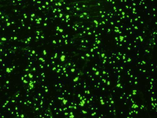 Immunofluorescent staining with GTX36927_E-coli-O157_1022.jpg.
