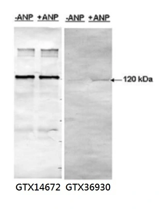 WB analysis of recombinant GFP-PDESA1 over-expressed cells treated with or without Atrial natriuretic peptide (ANP) using GTX14672 PDE5A antibody or GTX36930 PDE5A (phospho Ser 92) antibody.<br>Dilution : 1:500