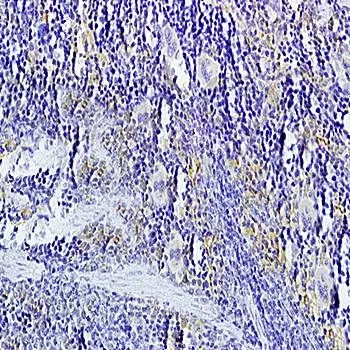 IHC-P analysis of rat spleen tissue using GTX37328 LIGHT antibody. Dilution : 1:200 IHC-P analysis of rat spleen tissue using GTX37328 LIGHT antibody. Dilution : 1:200