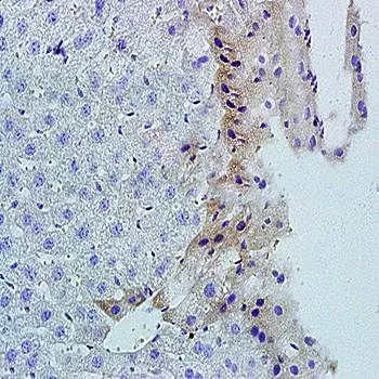 IHC-P analysis of mouse liver tissue using GTX37328 LIGHT antibody. Dilution : 1:200