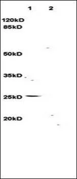 WB analysis of rat brain (Lane 1), rat kidney (Lane 2) tissue lysates using GTX37328 LIGHT antibody. Dilution : 1:3000