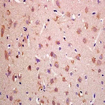 IHC-P analysis of rat brain tissue using GTX37345 Nav1.7 antibody. IHC-P analysis of rat brain tissue using GTX37345 Nav1.7 antibody.