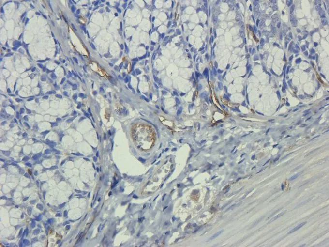IHC-P analysis of rat colon tissue using GTX37407 IL11 antibody. Dilution : 2.5microg/ml