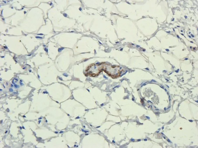 IHC-P analysis of rat skin tissue using GTX37407 IL11 antibody. Dilution : 2.5microg/ml
