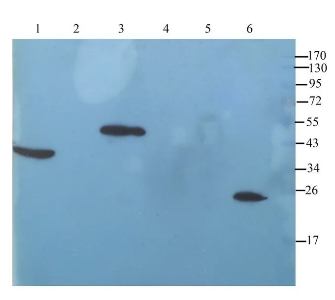 WB analysis of rat liver (Lane 1), mouse heart (Lane 2), rat colon (Lane 3), mouse spleen (Lane 4), mouse kidney (Lane 5), rat testis (Lane 6) lysates using GTX37407 IL11 antibody. Dilution : 1microg/ml