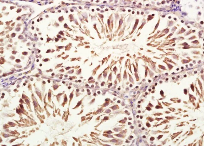 IHC-P analysis of rat testis tissue using GTX37414 VWCE antibody. IHC-P analysis of rat testis tissue using GTX37414 VWCE antibody.