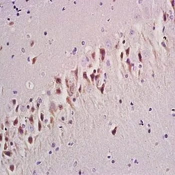 IHC-P analysis of rat brain tissue using GTX37416 mGluR1 antibody. Dilution : 1:200