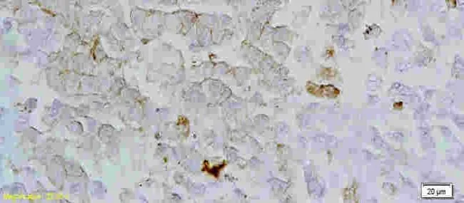 IHC-P analysis of rat lung tissue using GTX37417 GPR54 antibody.