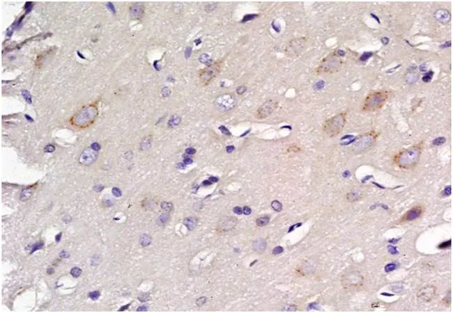 IHC-P analysis of rat brain tissue using GTX37432 EAAT2 antibody. Fixation : 4% PFA Antigen retireval : boiling with citrate buffer Dilution : 1:200