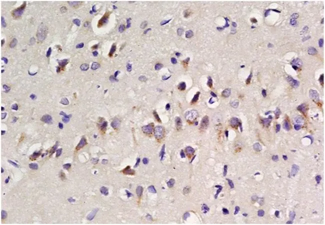IHC-P analysis of rat brain tissue using GTX37432 EAAT2 antibody. Fixation : 4% PFA Antigen retireval : boiling with citrate buffer Dilution : 1:200