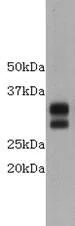 WB analysis of mouse thymus tissue lysate using GTX37508 CD8 alpha antibody. WB analysis of mouse thymus tissue lysate using GTX37508 CD8 alpha antibody.