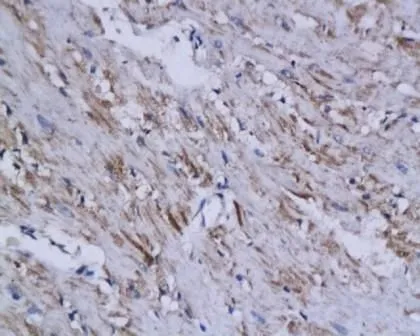 IHC-P analysis of human heart tissue using GTX37516 WDR26 antibody. IHC-P analysis of human heart tissue using GTX37516 WDR26 antibody.