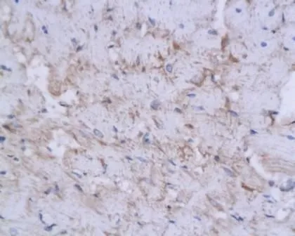 IHC-P analysis of human heart tissue using GTX37516 WDR26 antibody. Dilution : 1:200