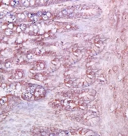IHC-P analysis of rat duodenum tissue using GTX37553 CD79a antibody. IHC-P analysis of rat duodenum tissue using GTX37553 CD79a antibody.
