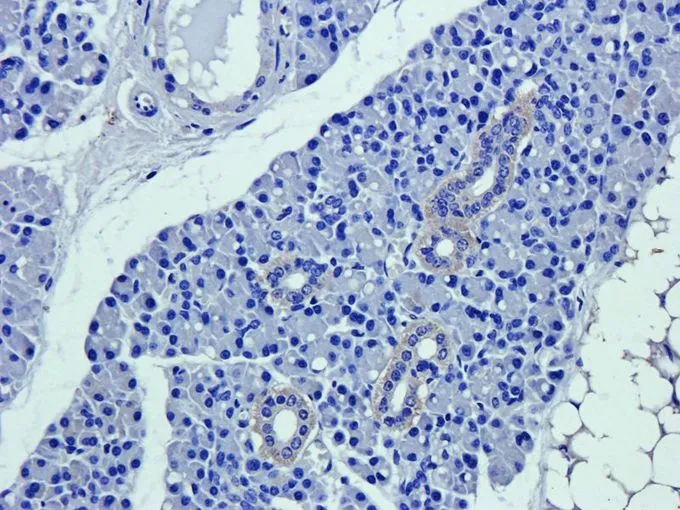 IHC-P analysis of mouse lymph node tissue using GTX37555 CD63 antibody. Dilution : 2.5microg/ml IHC-P analysis of mouse lymph node tissue using GTX37555 CD63 antibody. Dilution : 2.5microg/ml