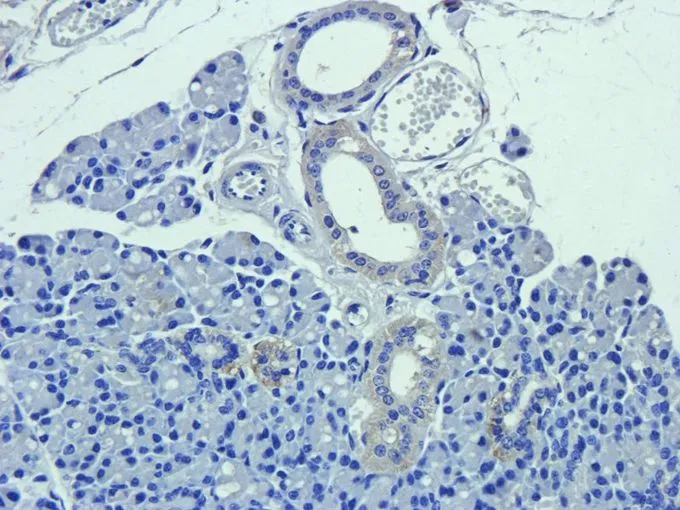 IHC-P analysis of mouse lymph node tissue using GTX37555 CD63 antibody. Dilution : 2.5microg/ml