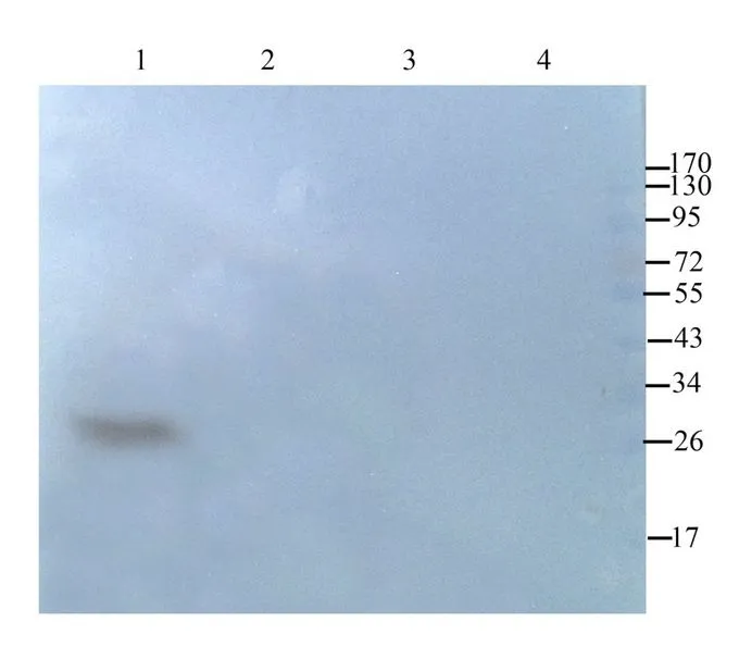 WB analysis of mouse heart (Lane 1), rat kidney (Lane 2), mouse spleen (Lane 3), rat thyroid (Lane 4) lysates using GTX37555 CD63 antibody. Dilution : 1microg/ml