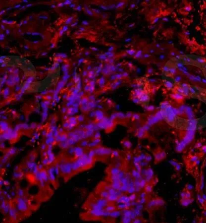IHC-Fr analysis of rat brain tissue using GTX37576 PACAP antibody. IHC-Fr analysis of rat brain tissue using GTX37576 PACAP antibody.