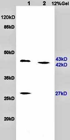 WB analysis of rat brain (Lane 1) and rat heart (Lane 2) tissue lysates using GTX37576 PACAP antibody.
