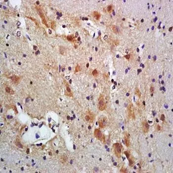 IHC-P analysis of rat brain tissue using GTX37577 PACAP antibody. Dilution : 1:200