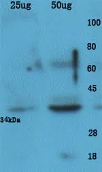 WB analysis of human colon cancer tissue lysate using GTX37582 Osteopontin antibody.
