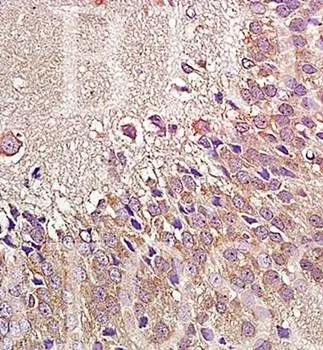 IHC-P analysis of rat brain tissue using GTX37593 NPY1R antibody.